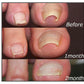 Corrective patches for healthy and beautiful nails 